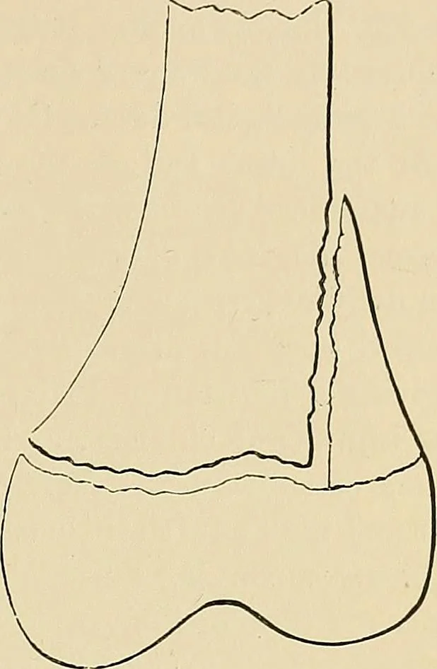 An illustration from The Röntgen rays in medical work, 1907, leaf 262