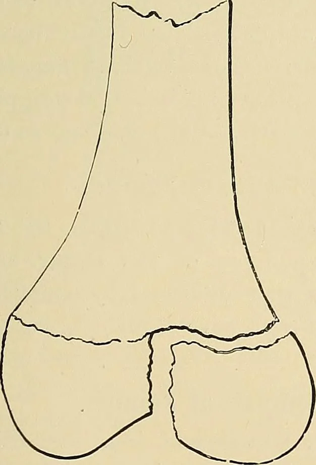 An illustration from The Röntgen rays in medical work, 1907, leaf 262