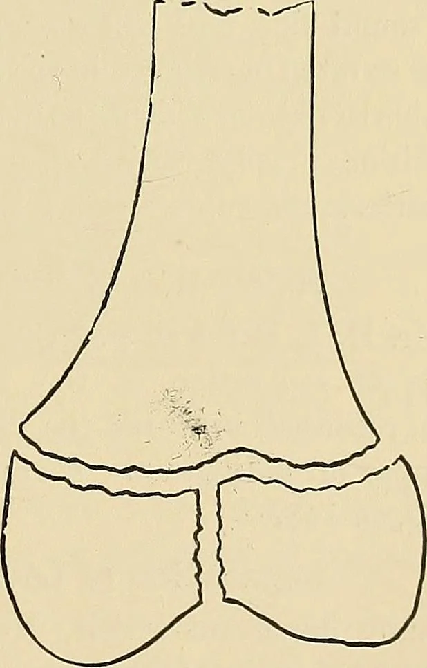 An illustration from The Röntgen rays in medical work, 1907, leaf 262