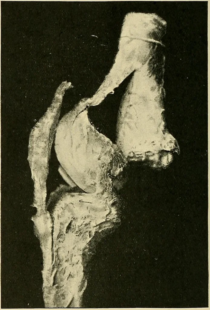 An illustration from The Röntgen rays in medical work, 1907, leaf 265