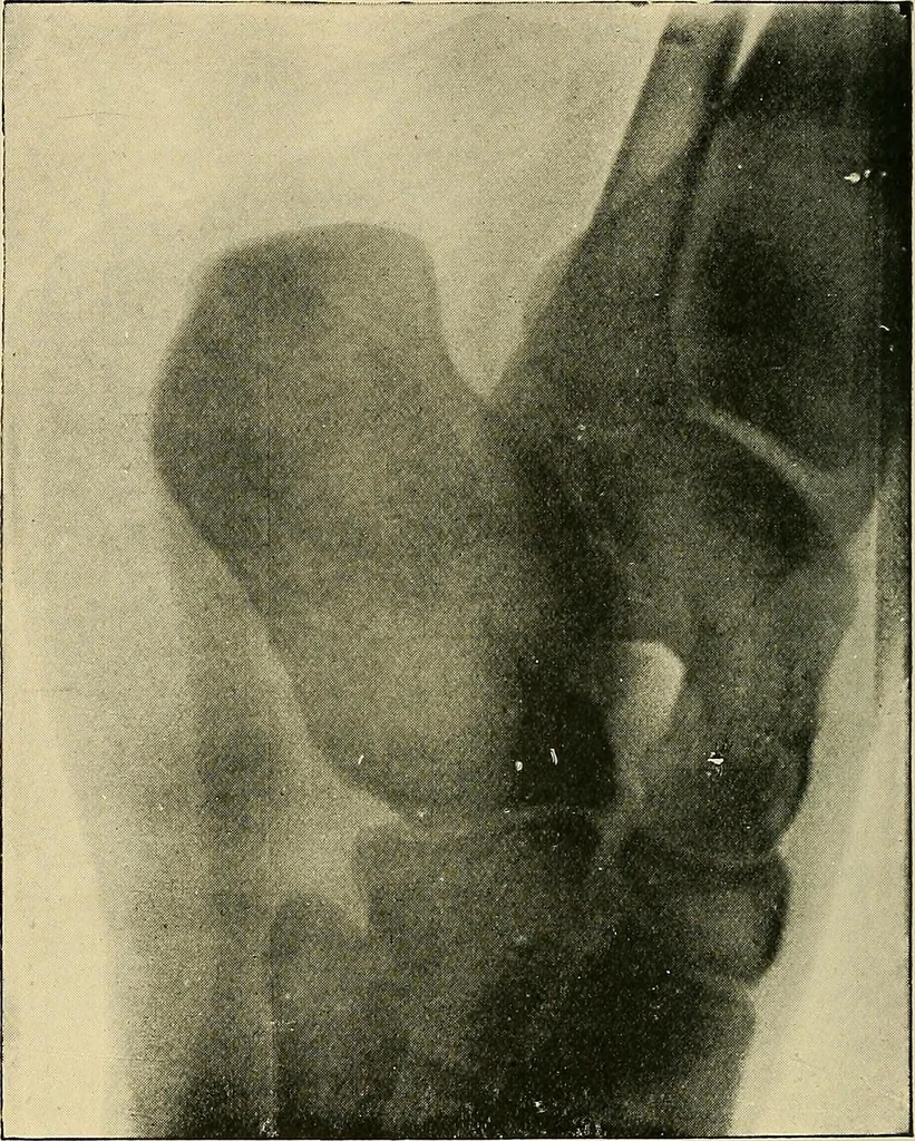 An illustration from The Röntgen rays in medical work, 1907, leaf 267
