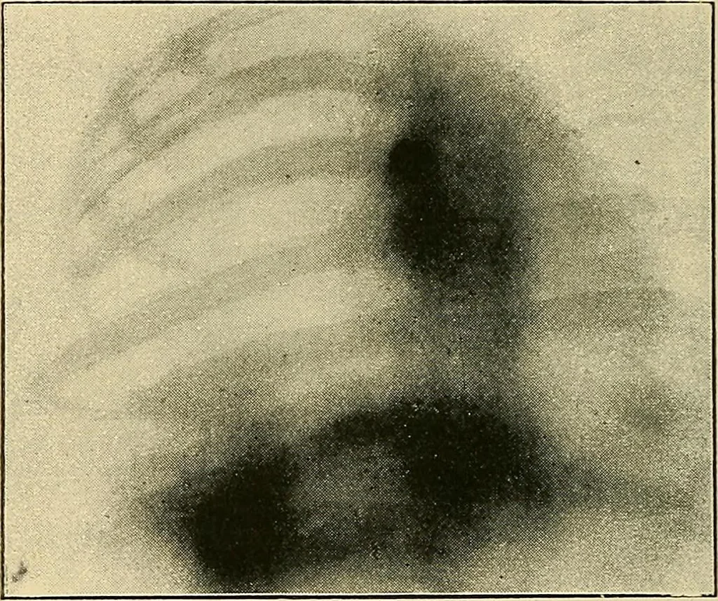 An illustration from The Röntgen rays in medical work, 1907, leaf 279