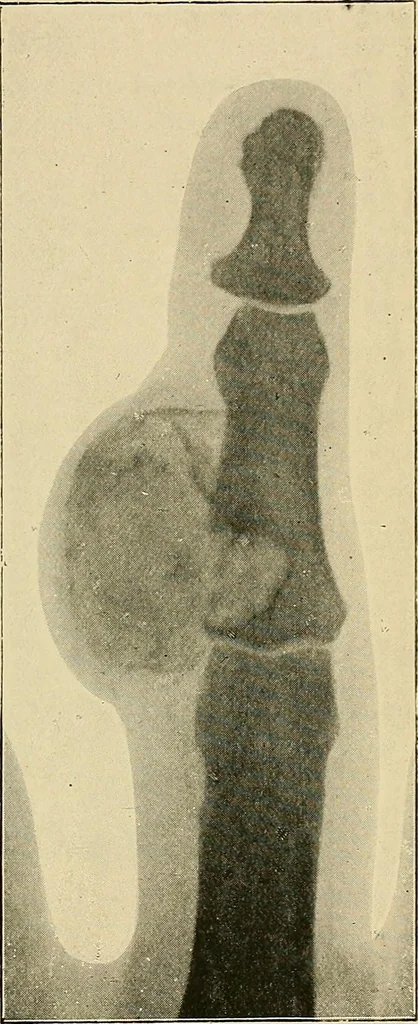 An illustration from The Röntgen rays in medical work, 1907, leaf 284