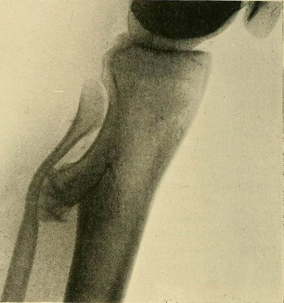 An illustration from The Röntgen rays in medical work, 1907, leaf 285