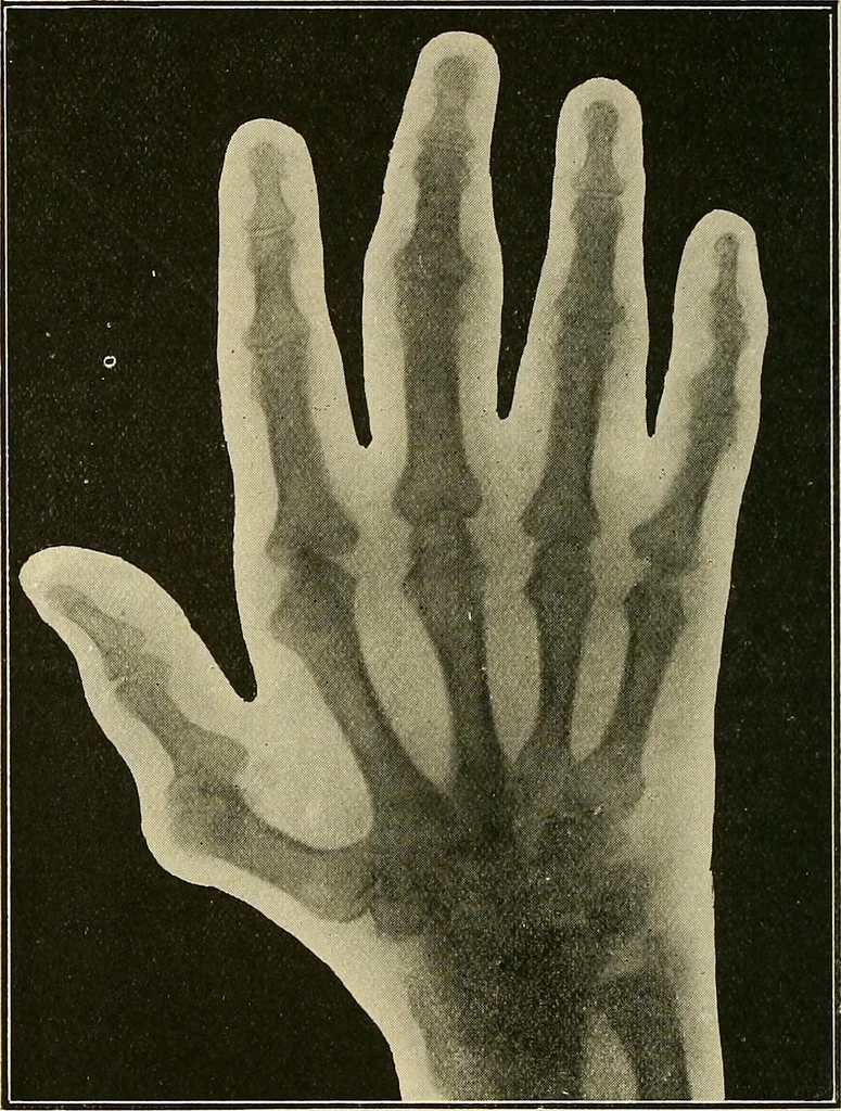 An illustration from The Röntgen rays in medical work, 1907, leaf 287