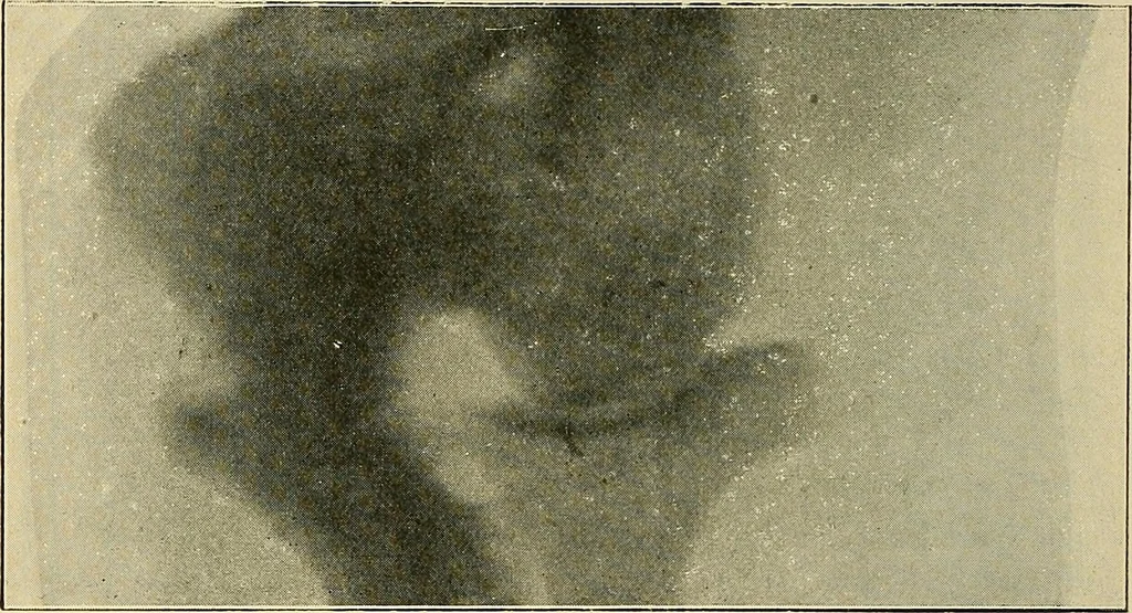 An illustration from The Röntgen rays in medical work, 1907, leaf 293