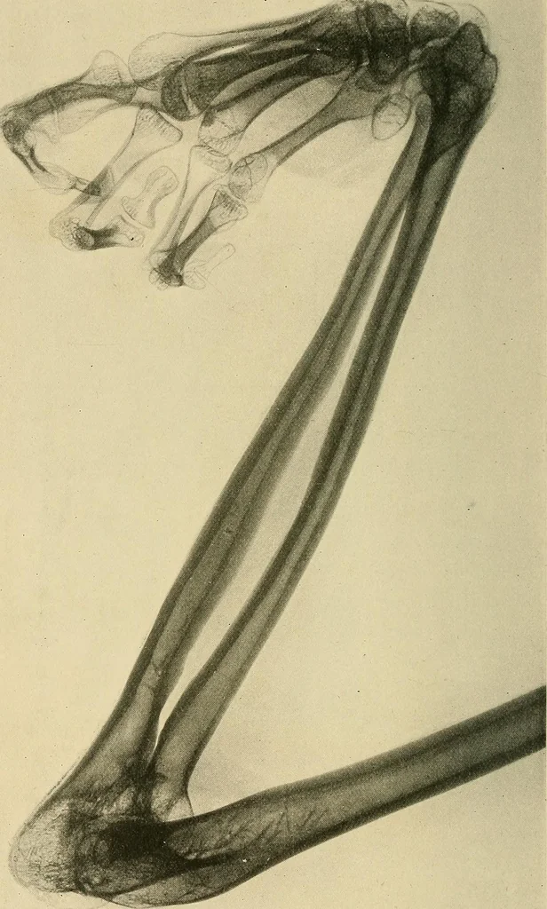 An illustration from The Röntgen rays in medical work, 1907, leaf 301