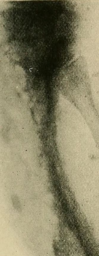 An illustration from The Röntgen rays in medical work, 1907, leaf 316