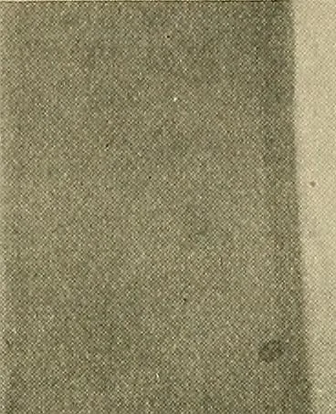 An illustration from The Röntgen rays in medical work, 1907, leaf 318