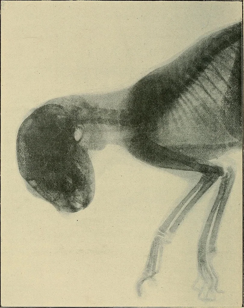 An illustration from The Röntgen rays in medical work, 1907, leaf 339