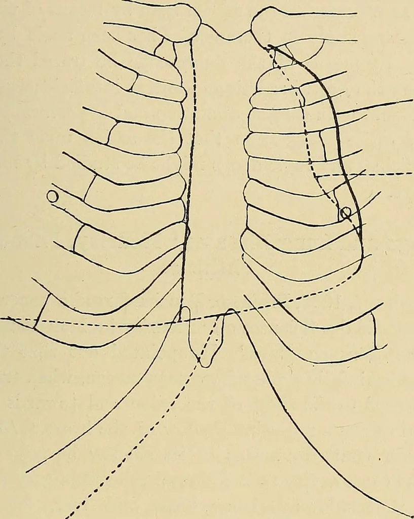 An illustration from The Röntgen rays in medical work, 1907, leaf 350