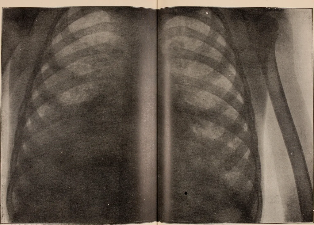 An illustration from The Röntgen rays in medical work, 1907, leaf 356