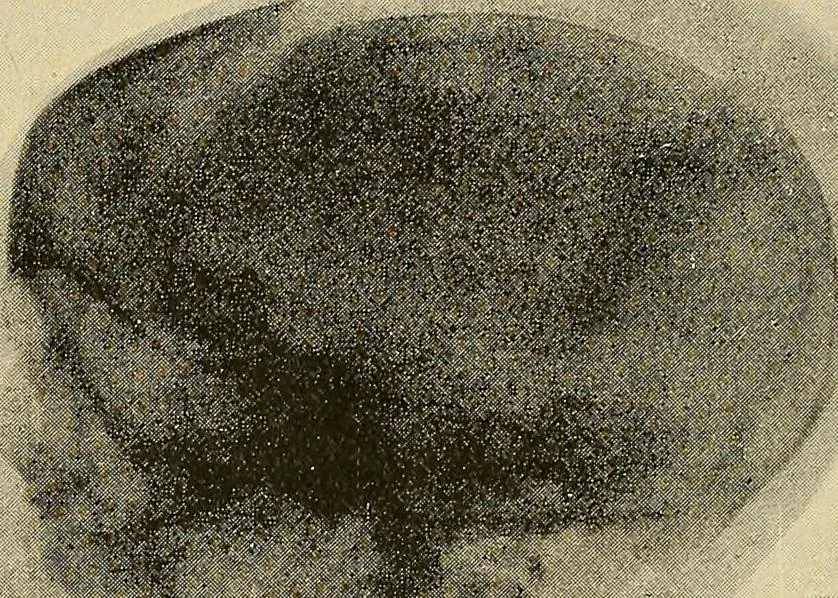 An illustration from The Röntgen rays in medical work, 1907, leaf 415