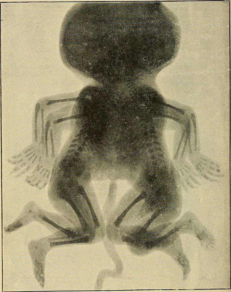 An illustration from The Röntgen rays in medical work, 1907, leaf 417