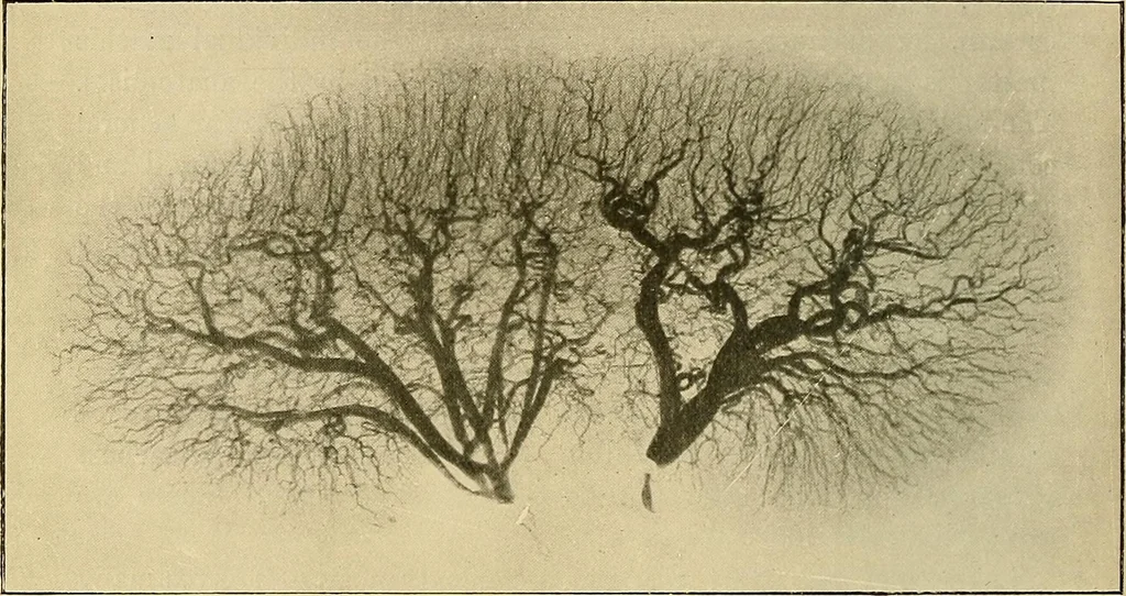 An illustration from The Röntgen rays in medical work, 1907, leaf 433