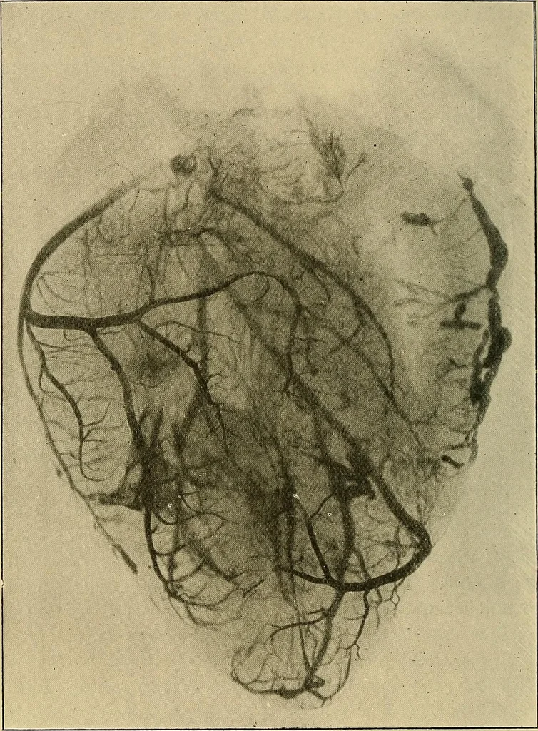 An illustration from The Röntgen rays in medical work, 1907, leaf 435