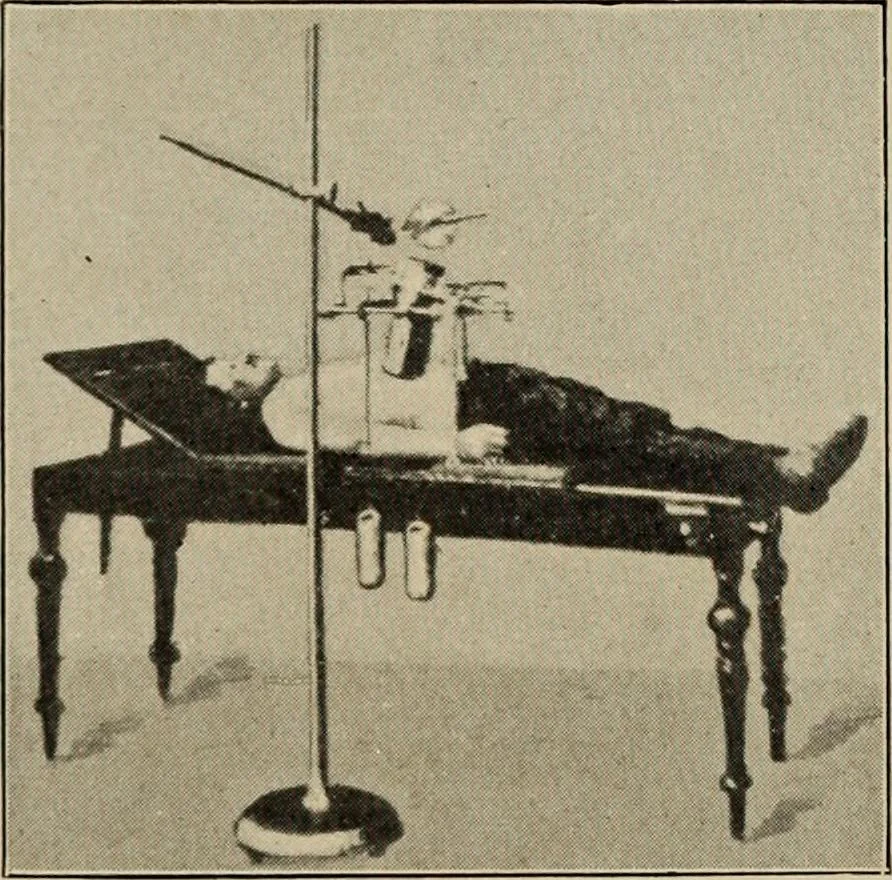 An illustration from Röntgentechniek : therapeutische beteekenis der "X" -stralen en der stoomen van hooge fréquentie, 1904, leaf 65