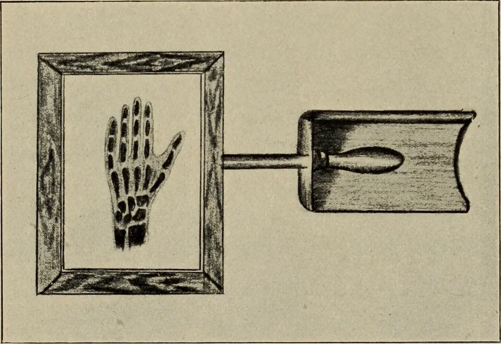 An illustration from Röntgentechniek : therapeutische beteekenis der "X" -stralen en der stoomen van hooge fréquentie, 1904, leaf 76