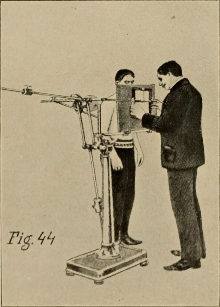 An illustration from Röntgentechniek : therapeutische beteekenis der "X" -stralen en der stoomen van hooge fréquentie, 1904, leaf 77