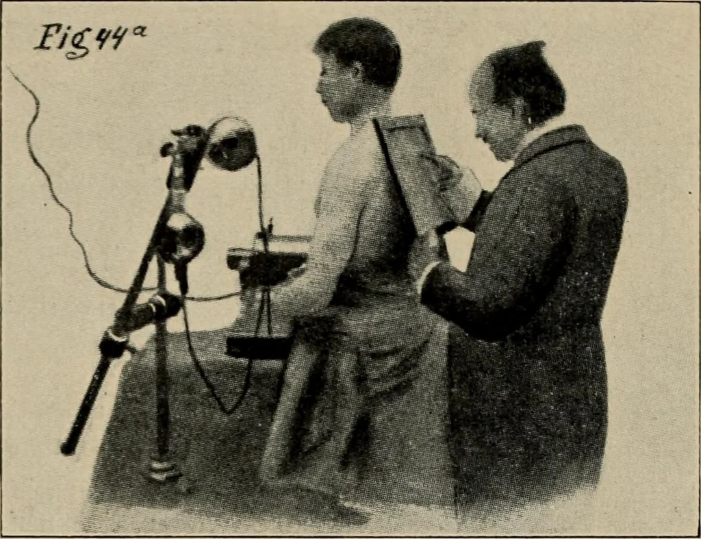 An illustration from Röntgentechniek : therapeutische beteekenis der "X" -stralen en der stoomen van hooge fréquentie, 1904, leaf 79