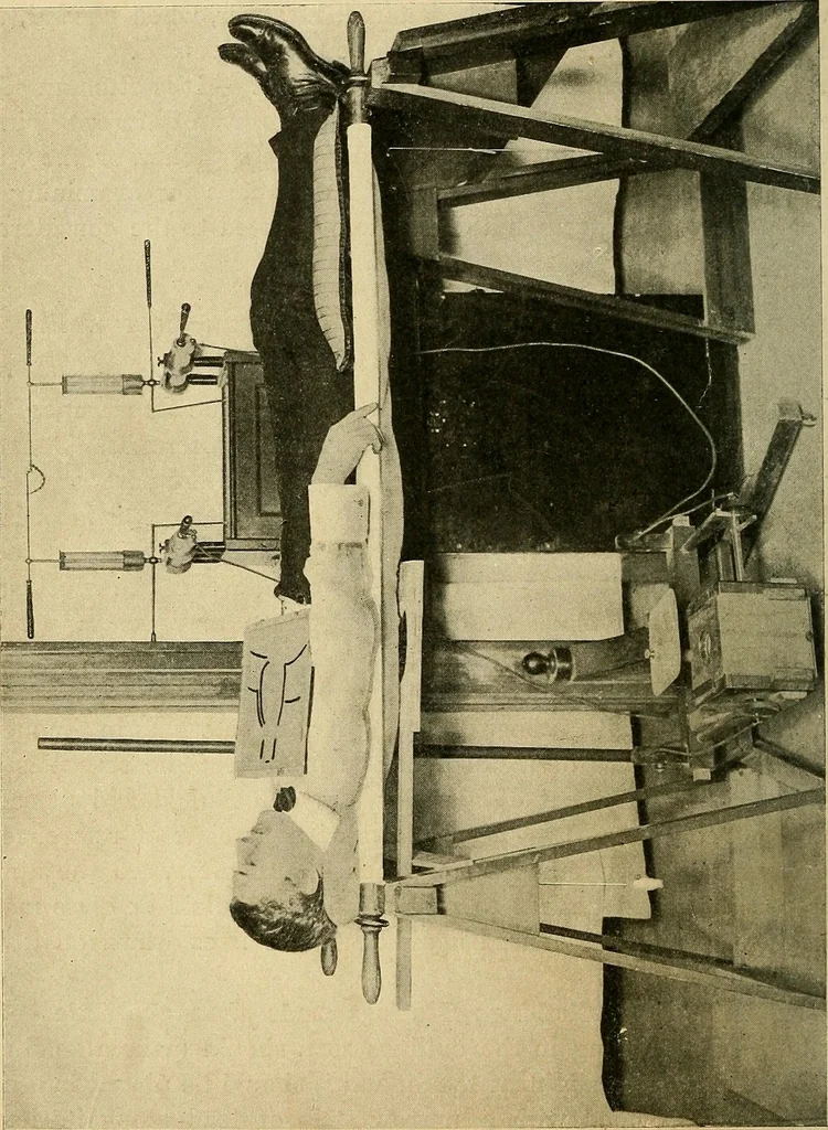 An illustration from The Roentgen rays in medicine and surgery as an aid in diagnosis and as a therapeutic agent : designed for the use of practitioners and students, 1901, leaf 109