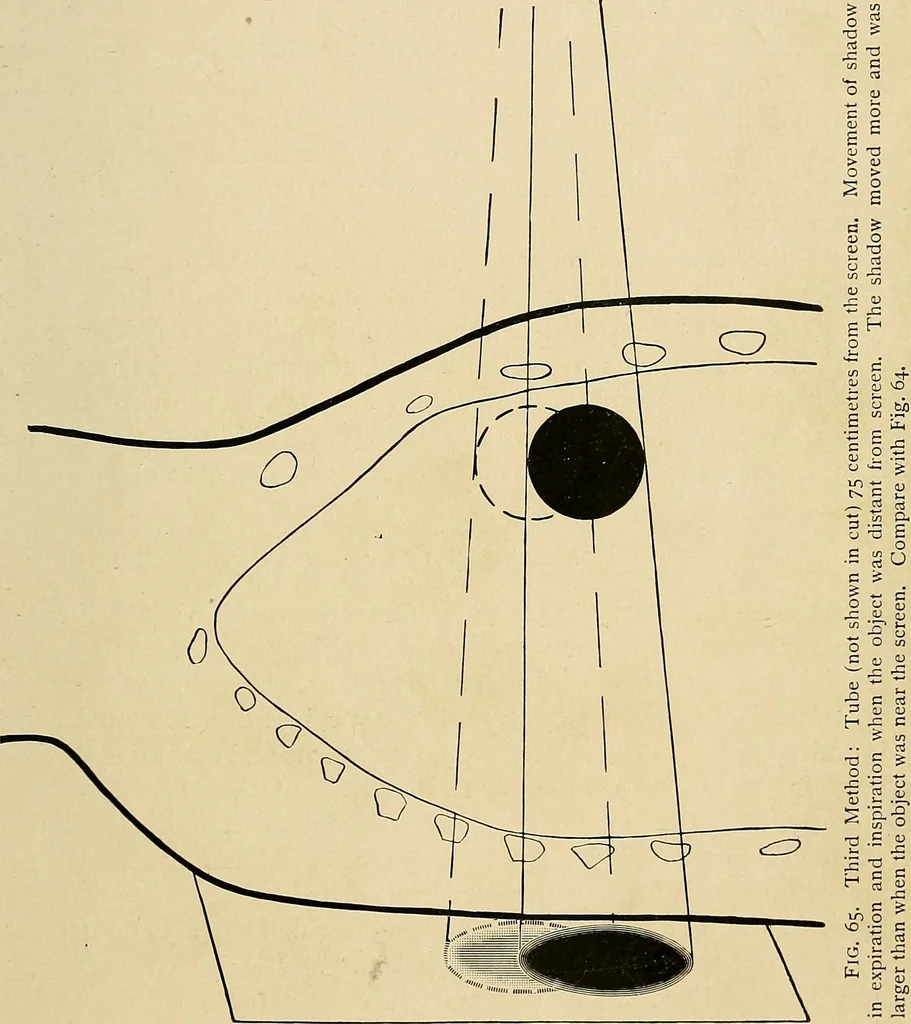 An illustration from The Roentgen rays in medicine and surgery as an aid in diagnosis and as a therapeutic agent : designed for the use of practitioners and students, 1901, leaf 116