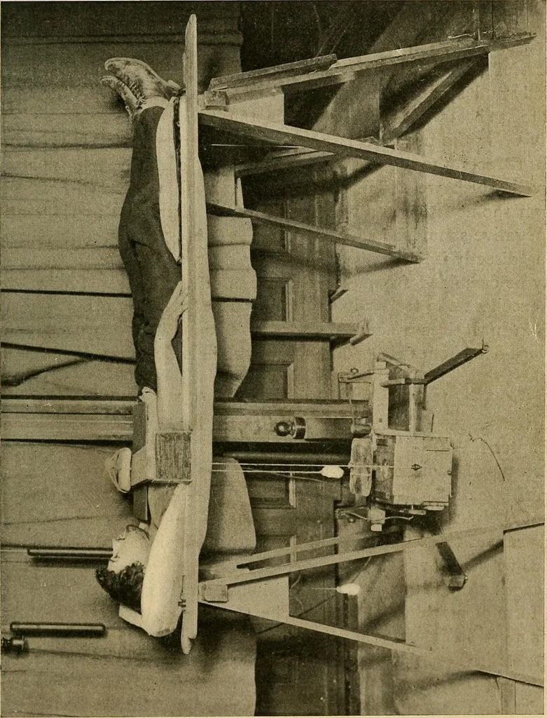 An illustration from The Roentgen rays in medicine and surgery as an aid in diagnosis and as a therapeutic agent : designed for the use of practitioners and students, 1901, leaf 126