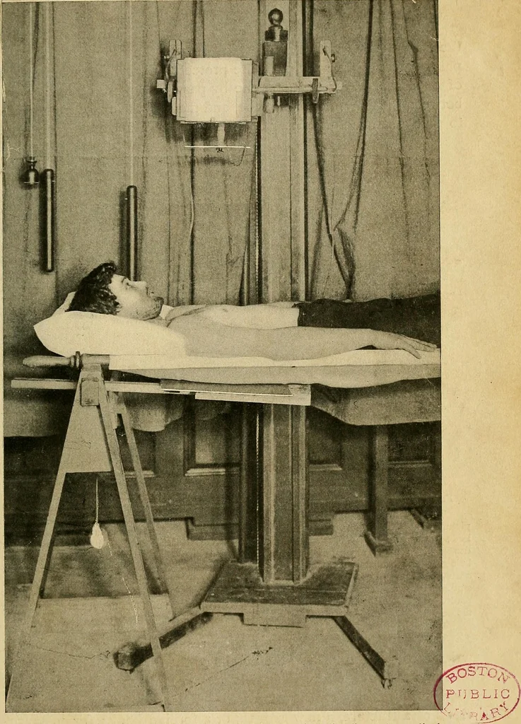An illustration from The Roentgen rays in medicine and surgery as an aid in diagnosis and as a therapeutic agent : designed for the use of practitioners and students, 1901, leaf 128