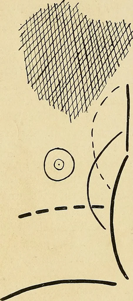 An illustration from The Roentgen rays in medicine and surgery as an aid in diagnosis and as a therapeutic agent : designed for the use of practitioners and students, 1901, leaf 155