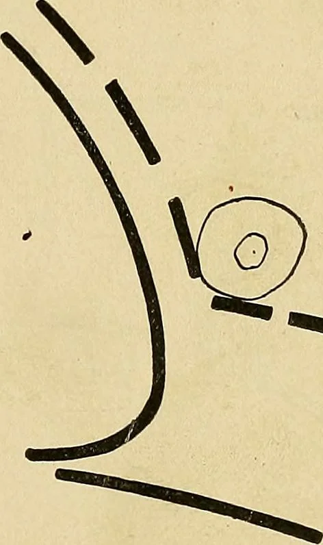 An illustration from The Roentgen rays in medicine and surgery as an aid in diagnosis and as a therapeutic agent : designed for the use of practitioners and students, 1901, leaf 158