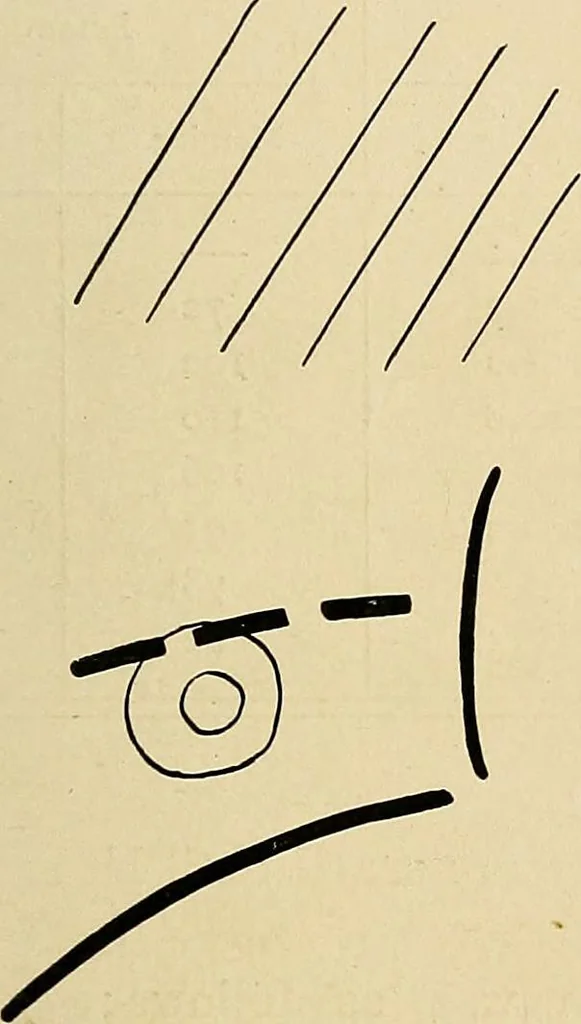 An illustration from The Roentgen rays in medicine and surgery as an aid in diagnosis and as a therapeutic agent : designed for the use of practitioners and students, 1901, leaf 160