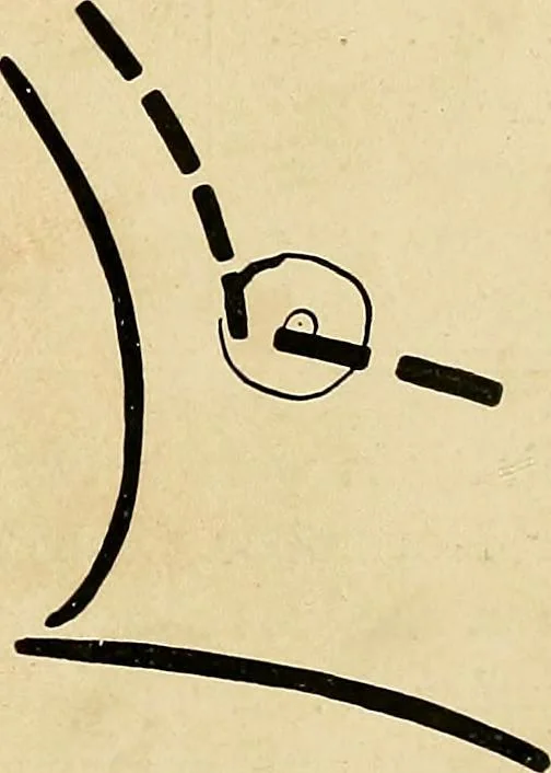 An illustration from The Roentgen rays in medicine and surgery as an aid in diagnosis and as a therapeutic agent : designed for the use of practitioners and students, 1901, leaf 160