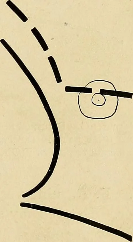 An illustration from The Roentgen rays in medicine and surgery as an aid in diagnosis and as a therapeutic agent : designed for the use of practitioners and students, 1901, leaf 164