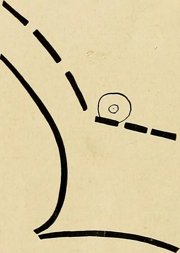 An illustration from The Roentgen rays in medicine and surgery as an aid in diagnosis and as a therapeutic agent : designed for the use of practitioners and students, 1901, leaf 172