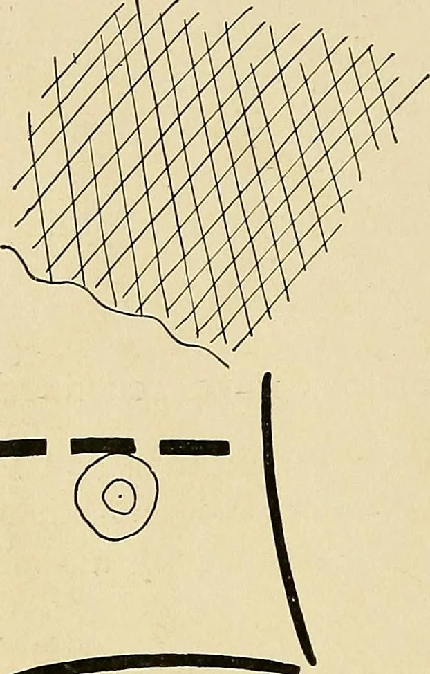 An illustration from The Roentgen rays in medicine and surgery as an aid in diagnosis and as a therapeutic agent : designed for the use of practitioners and students, 1901, leaf 177