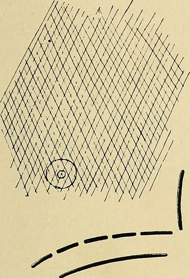 An illustration from The Roentgen rays in medicine and surgery as an aid in diagnosis and as a therapeutic agent : designed for the use of practitioners and students, 1901, leaf 178