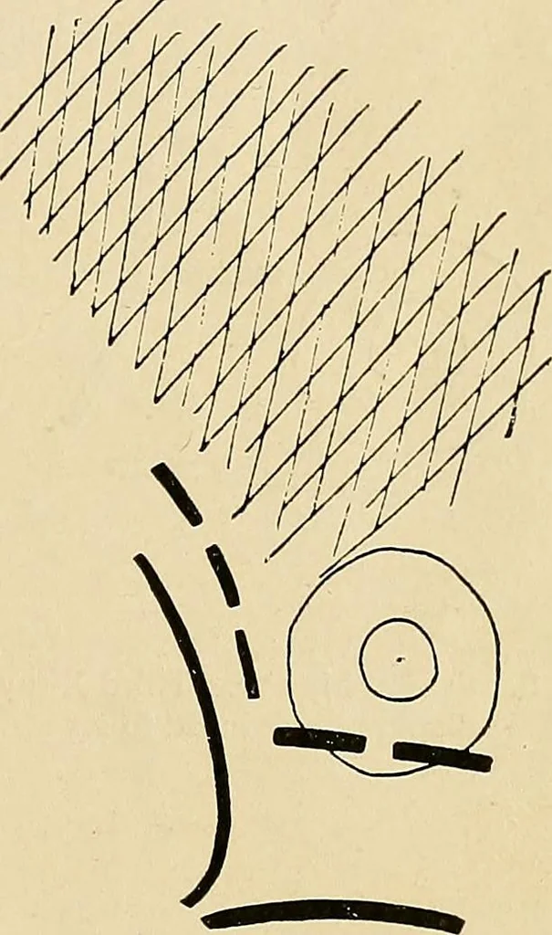 An illustration from The Roentgen rays in medicine and surgery as an aid in diagnosis and as a therapeutic agent : designed for the use of practitioners and students, 1901, leaf 180