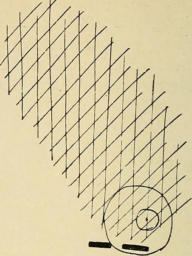 An illustration from The Roentgen rays in medicine and surgery as an aid in diagnosis and as a therapeutic agent : designed for the use of practitioners and students, 1901, leaf 181