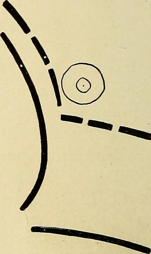 An illustration from The Roentgen rays in medicine and surgery as an aid in diagnosis and as a therapeutic agent : designed for the use of practitioners and students, 1901, leaf 183