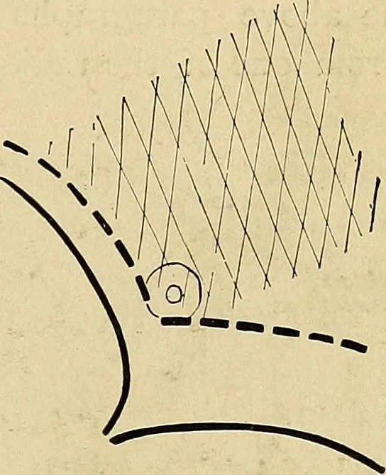 An illustration from The Roentgen rays in medicine and surgery as an aid in diagnosis and as a therapeutic agent : designed for the use of practitioners and students, 1901, leaf 194