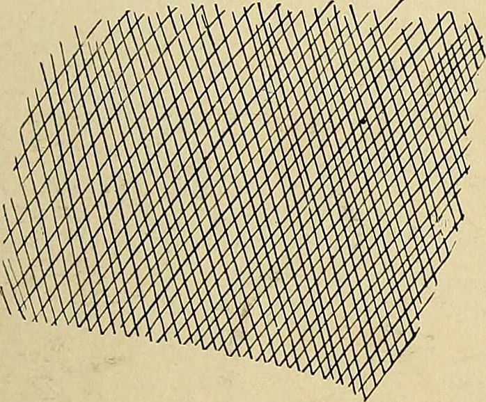 An illustration from The Roentgen rays in medicine and surgery as an aid in diagnosis and as a therapeutic agent : designed for the use of practitioners and students, 1901, leaf 196