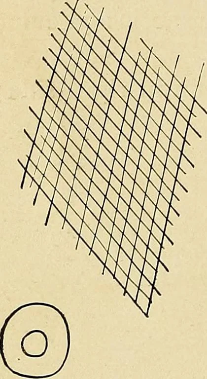 An illustration from The Roentgen rays in medicine and surgery as an aid in diagnosis and as a therapeutic agent : designed for the use of practitioners and students, 1901, leaf 197