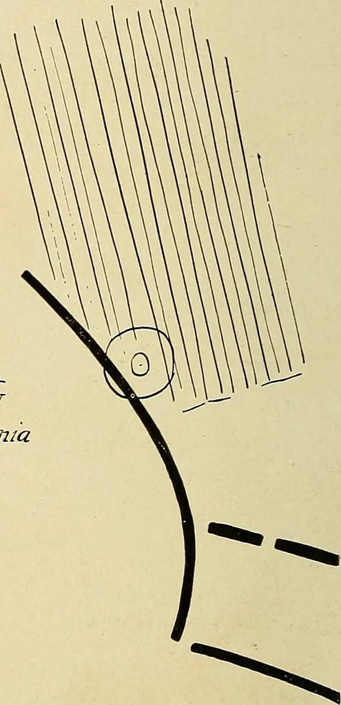 An illustration from The Roentgen rays in medicine and surgery as an aid in diagnosis and as a therapeutic agent : designed for the use of practitioners and students, 1901, leaf 197
