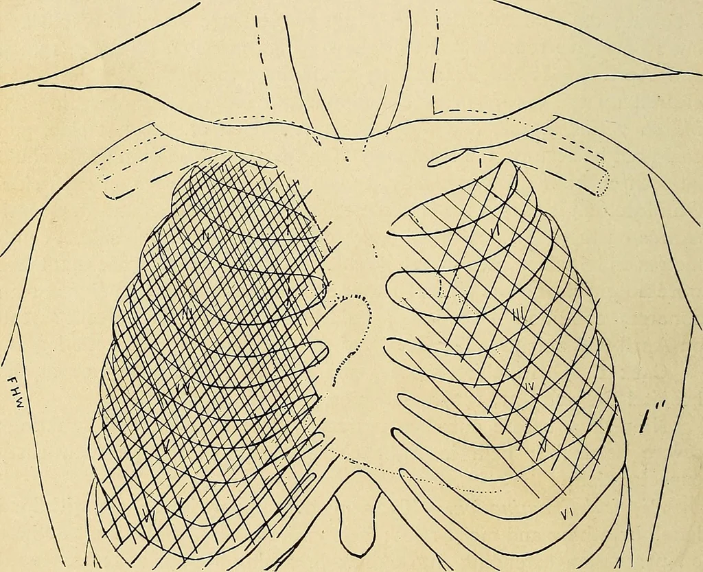 An illustration from The Roentgen rays in medicine and surgery as an aid in diagnosis and as a therapeutic agent : designed for the use of practitioners and students, 1901, leaf 201