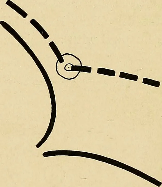 An illustration from The Roentgen rays in medicine and surgery as an aid in diagnosis and as a therapeutic agent : designed for the use of practitioners and students, 1901, leaf 208