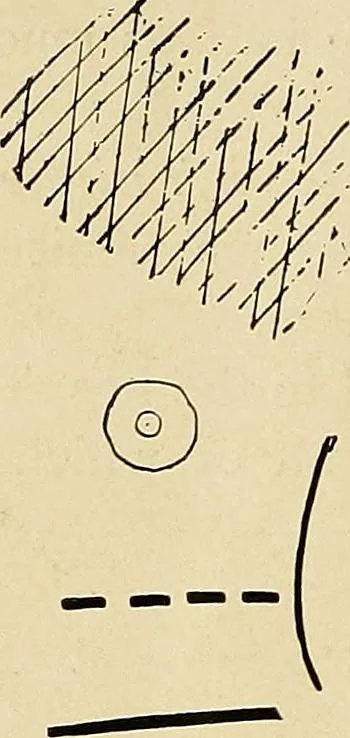 An illustration from The Roentgen rays in medicine and surgery as an aid in diagnosis and as a therapeutic agent : designed for the use of practitioners and students, 1901, leaf 209
