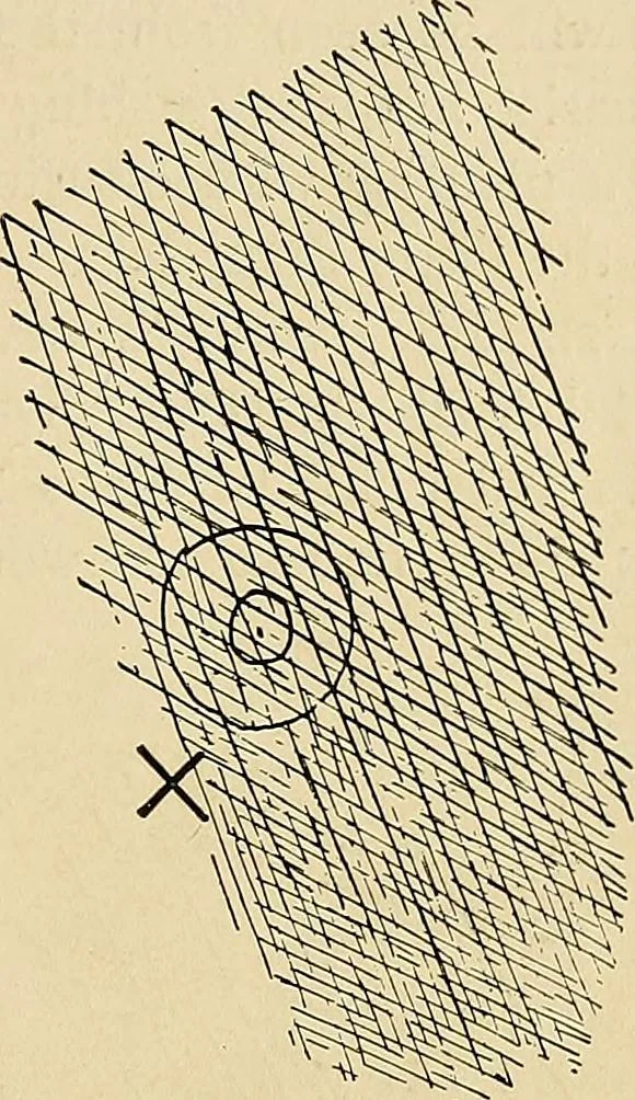 An illustration from The Roentgen rays in medicine and surgery as an aid in diagnosis and as a therapeutic agent : designed for the use of practitioners and students, 1901, leaf 214