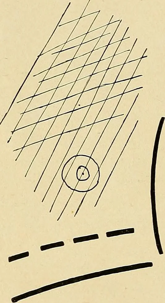 An illustration from The Roentgen rays in medicine and surgery as an aid in diagnosis and as a therapeutic agent : designed for the use of practitioners and students, 1901, leaf 215