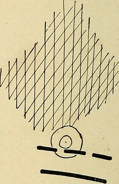An illustration from The Roentgen rays in medicine and surgery as an aid in diagnosis and as a therapeutic agent : designed for the use of practitioners and students, 1901, leaf 215