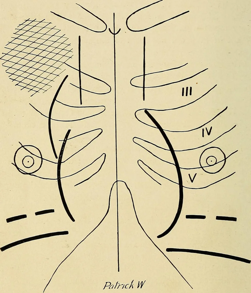 An illustration from The Roentgen rays in medicine and surgery as an aid in diagnosis and as a therapeutic agent : designed for the use of practitioners and students, 1901, leaf 221